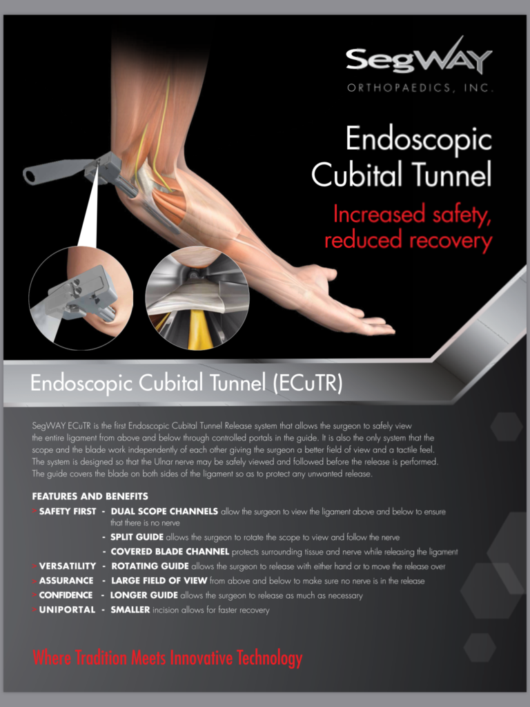 Seg Way Endoscopic Cubital Tunnel Release Pacific Medical Inc