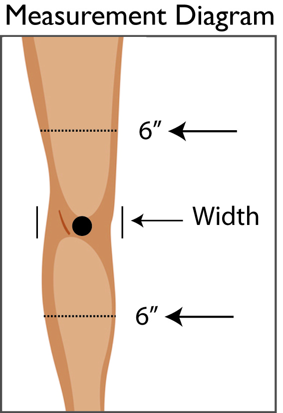 Knee-Diagram-6-above_6-below